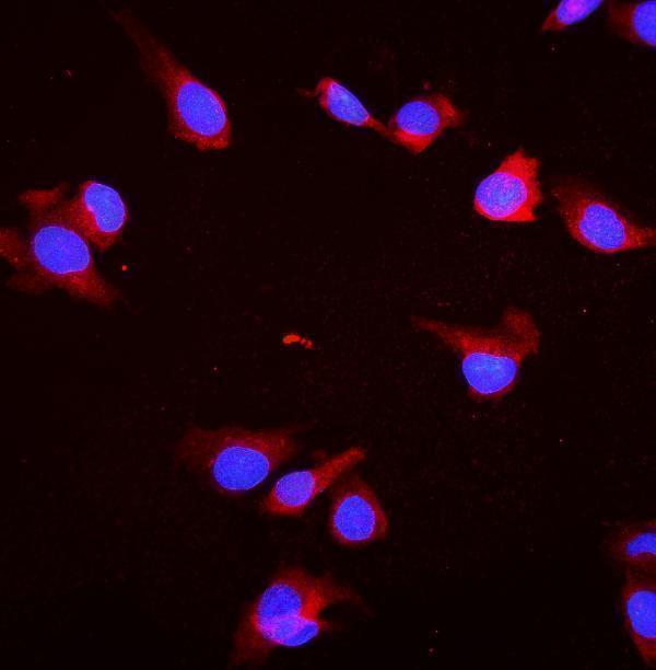 pa1816 hspa8 primary antibodies if testing 4