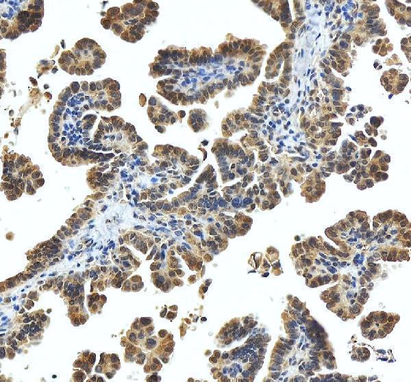 pa1816 hspa8 primary antibodies ihc testing 4