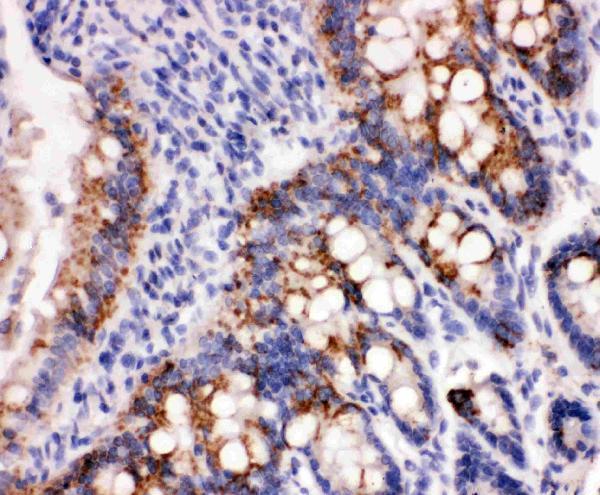 pa1835 2 ihc anti peroxiredoxin 3 antibody