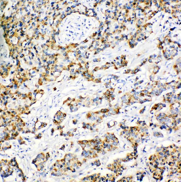 pa1836 3 ihc anti peroxiredoxin 3 antibody