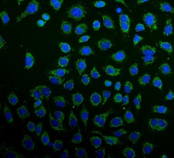 pa1836 prdx3 primary antibodies if testing 4