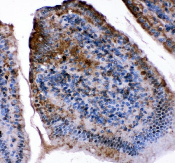 pa1853 fabp5 primary antibodies ihc testing 2