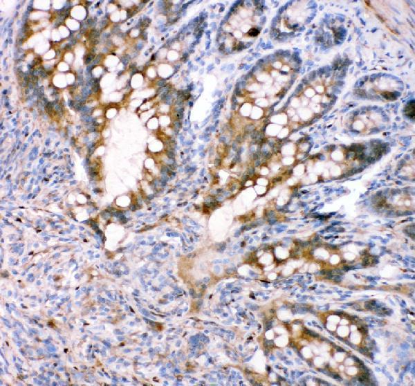 pa1853 fabp5 primary antibodies ihc testing 3