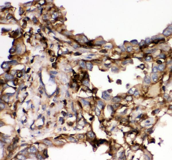  IHC analysis of SHP2/PTPN11 using anti-SHP2/PTPN11 antibody (PA1860)