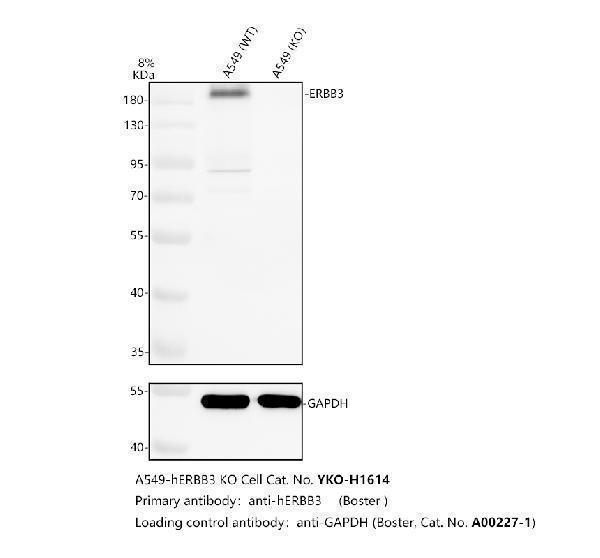 Western blot analysis of ERBB3 using anti-ERBB3 antibody (PA1880)