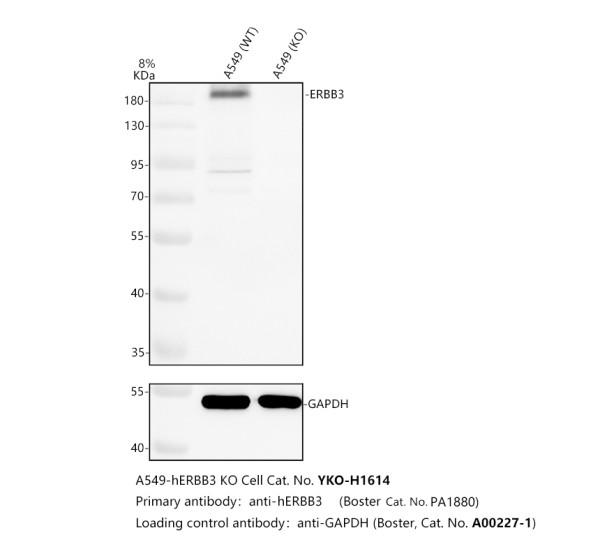 Western blot analysis of ERBB3 using anti-ERBB3 antibody (PA1880)