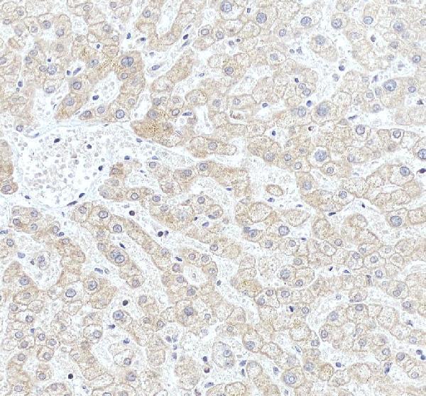 pa1883 fmo4 primary antibodies ihc testing 3