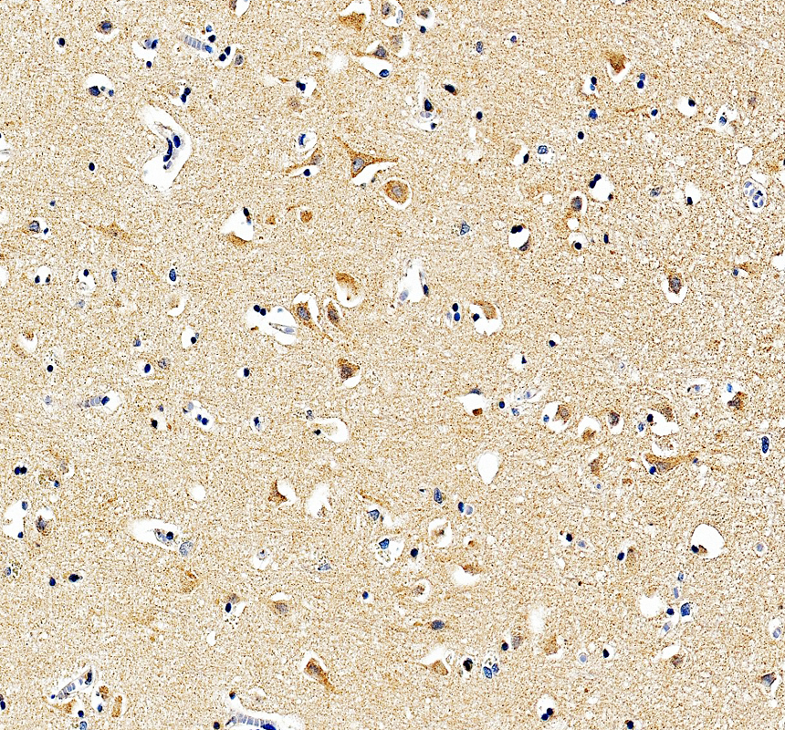 IHC analysis of CSF1R using anti-CSF1R antibody (PA1905)