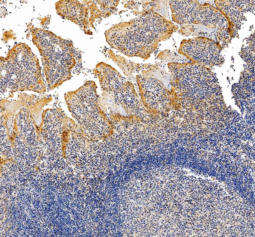 IHC analysis of CSF1R using anti-CSF1R antibody (PA1905)