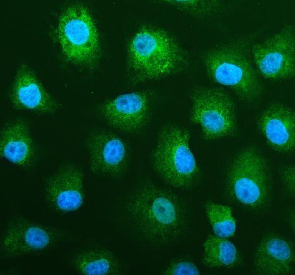 pa1920 malt1 primary antibodies if testing 1