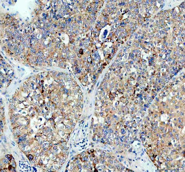 IHC analysis of MALT1 using anti-MALT1 antibody (PA1920)