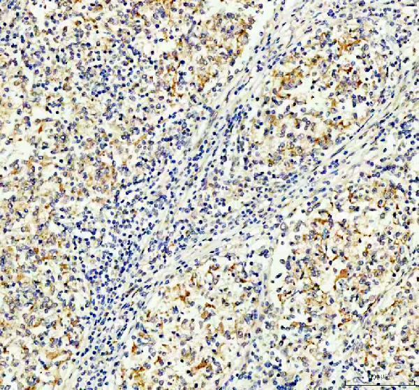 IHC analysis of MALT1 using anti-MALT1 antibody (PA1920)