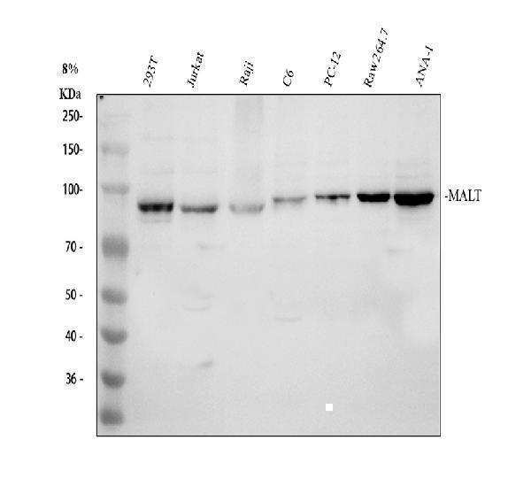 Western blot analysis of MALT1 using anti-MALT1 antibody (PA1920)