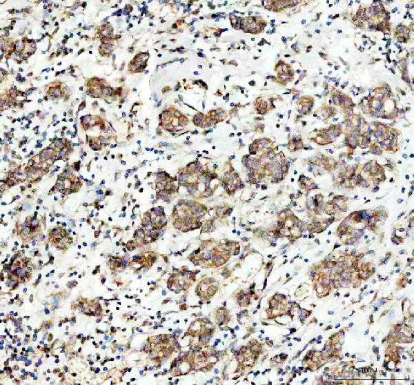 pa1923 map3k1 primary antibodies ihc testing 1