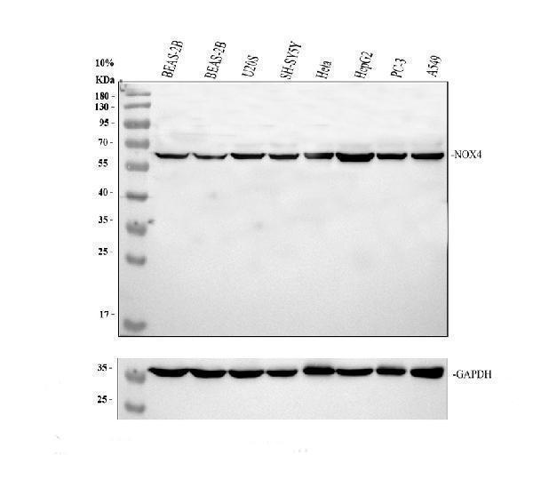 Western blot analysis of NOX4 using anti-NOX4 antibody (PA1929)