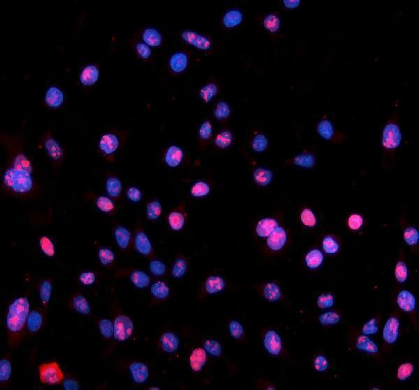 pa1931 nucleophosmin primary antibodies if testing 9