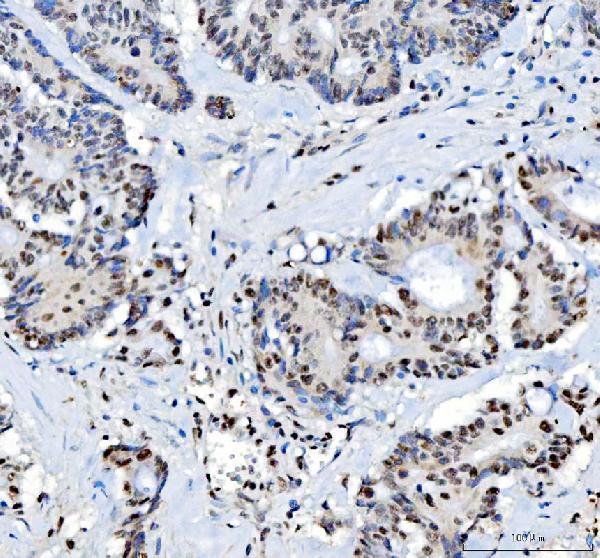 pa1931 nucleophosmin primary antibodies ihc testing 3
