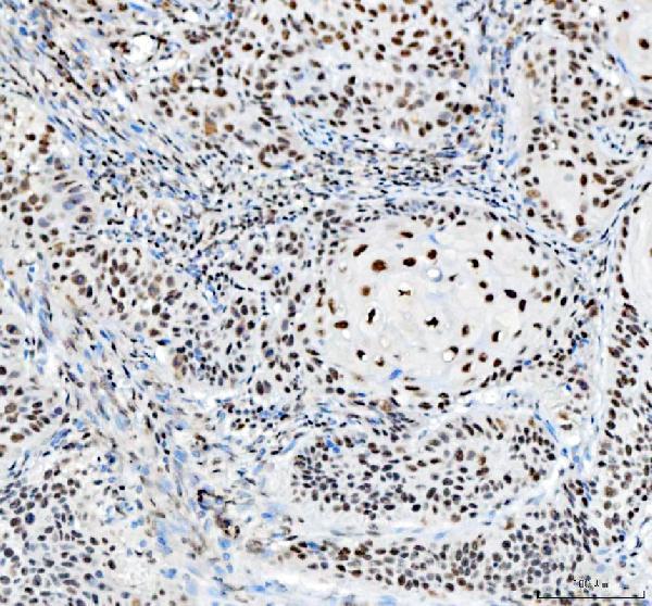 pa1931 nucleophosmin primary antibodies ihc testing 4