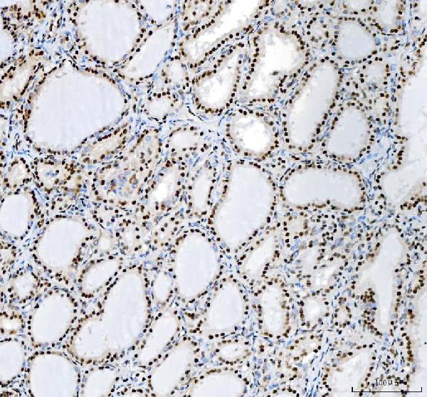 pa1931 nucleophosmin primary antibodies ihc testing 5