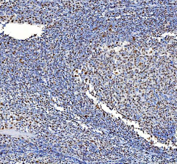 pa1931 nucleophosmin primary antibodies ihc testing 6