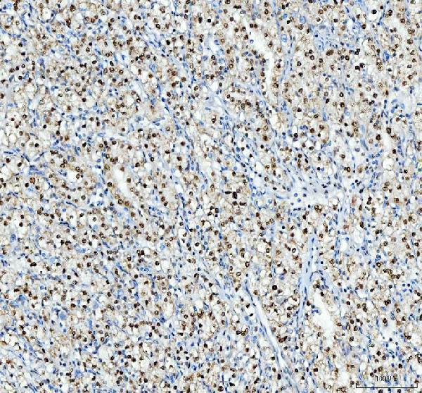 pa1931 nucleophosmin primary antibodies ihc testing 7