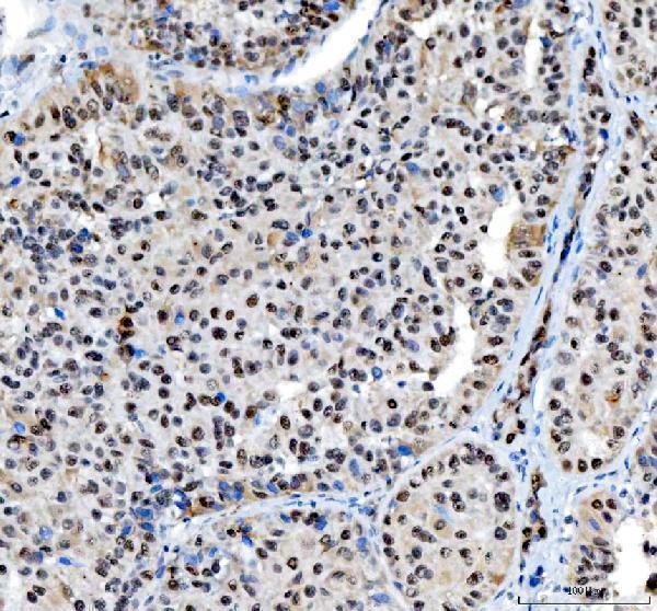 pa1931 nucleophosmin primary antibodies ihc testing 8