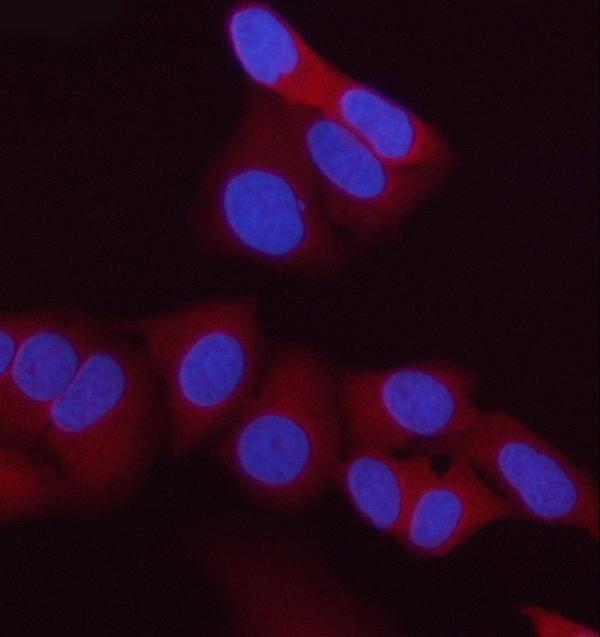 pa1935 st13 primary antibodies if testing 2