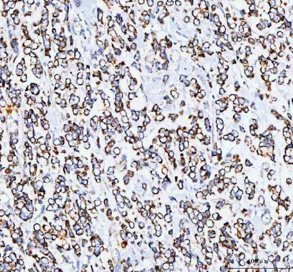 pa1936 mttfa primary antibodies ihc testing 2