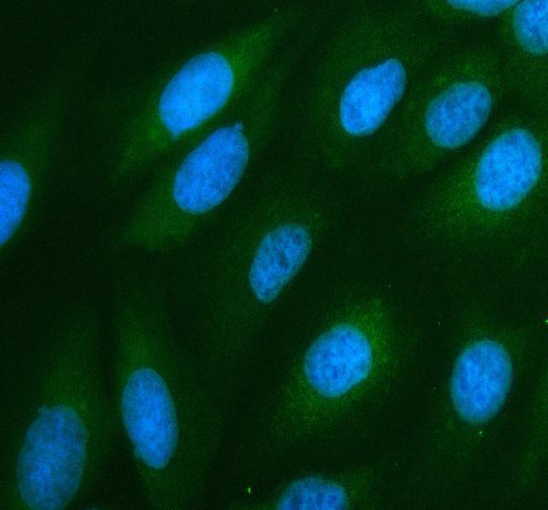 pa1947 nox5 primary antibodies if testing 1
