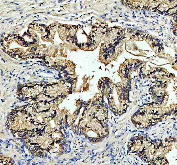 pa1947 nox5 primary antibodies ihc testing 1