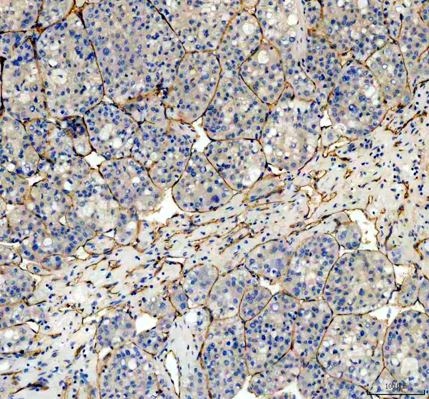 IHC analysis of PECAM1/CD31 using anti-PECAM1/CD31 antibody (PA1950-1)