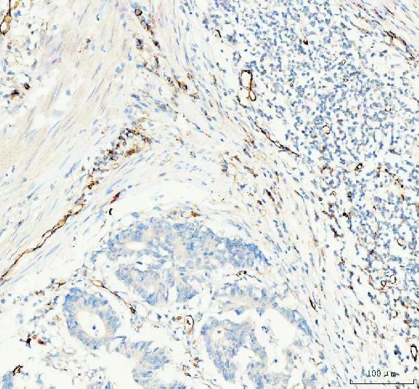  IHC analysis of CD31/PECAM1 using anti-CD31/PECAM1 antibody (PA1950-1)