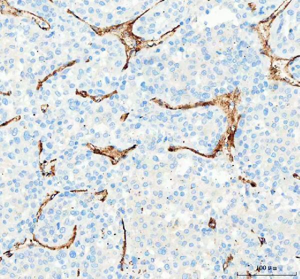 pa1950 1 pecam1 primary antibodies ihc testing 4_1