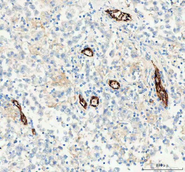 pa1950 1 pecam1 primary antibodies ihc testing 6