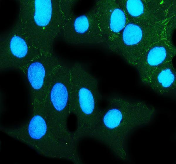 pa1957 tjp2 primary antibodies if testing 4