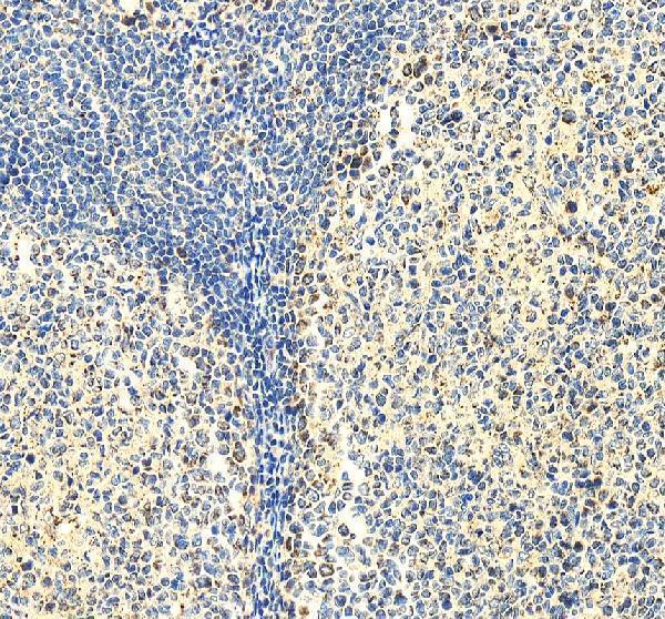 pa1964 ddx5 primary antibodies ihc testing 3
