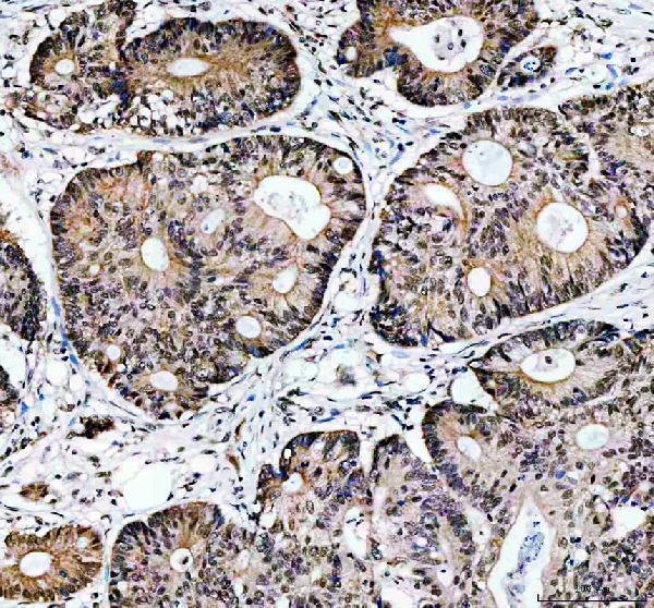 pa1970 prkdc primary antibodies ihc testing 1