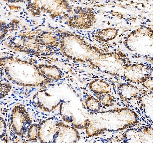 pa1970 prkdc primary antibodies ihc testing 2
