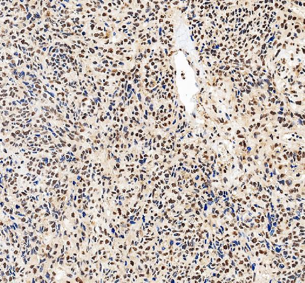 pa1970 prkdc primary antibodies ihc testing 3