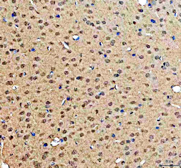pa1970 prkdc primary antibodies ihc testing 5