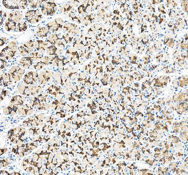 pa1971 tjp2 primary antibodies ihc testing 1