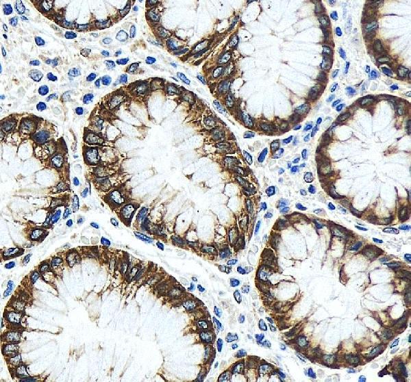 pa1971 tjp2 primary antibodies ihc testing 4