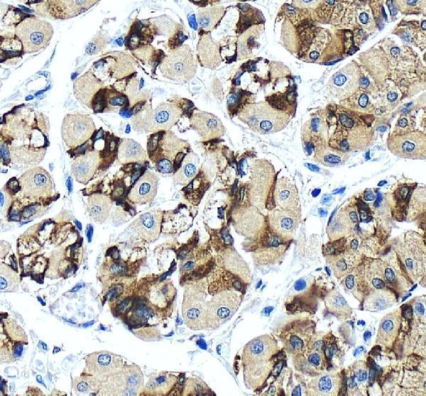 pa1971 tjp2 primary antibodies ihc testing 5