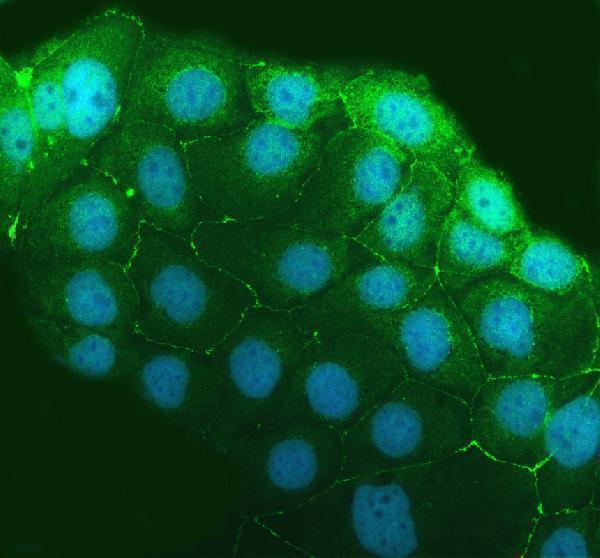 pa1972 tjp3 primary antibodies if testing 1