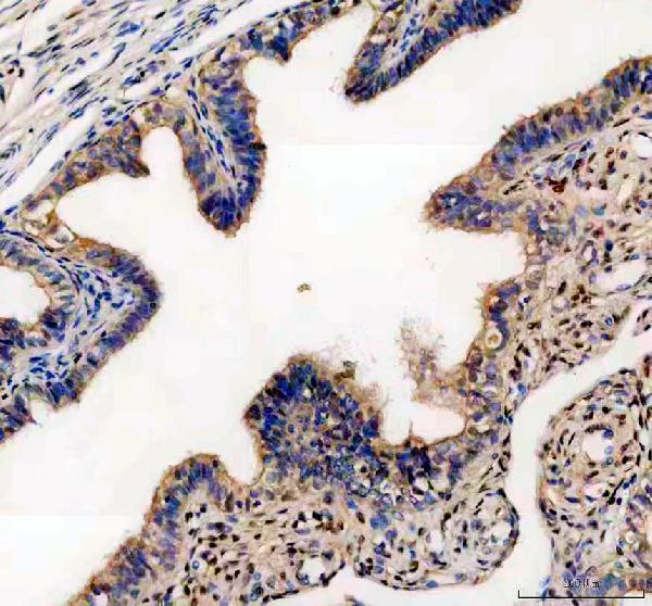 pa1972 tjp3 primary antibodies ihc testing 1