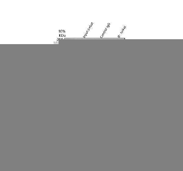 pa1994 pdk2 primary antibodies ip testing 1
