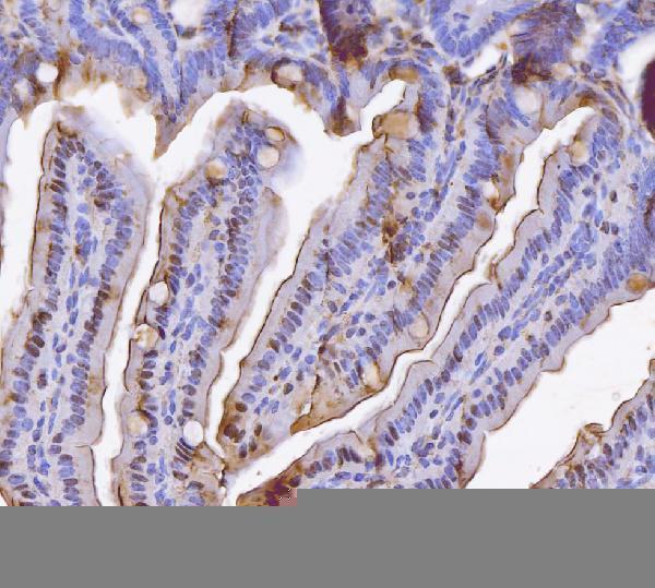  IHC analysis of Bid using anti-Bid antibody (PA2015)