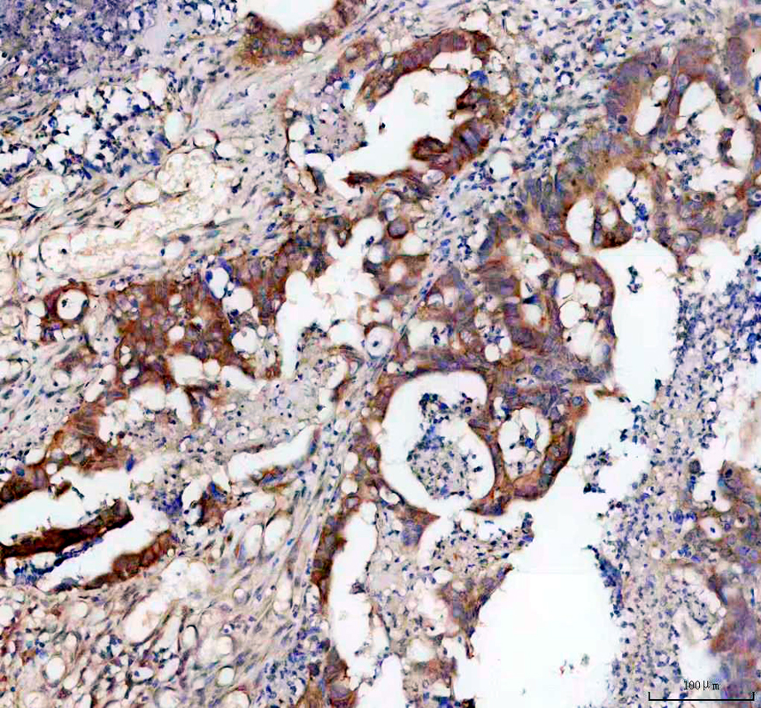 pa2029 eif2s1 primary antibodies ihc testing 1