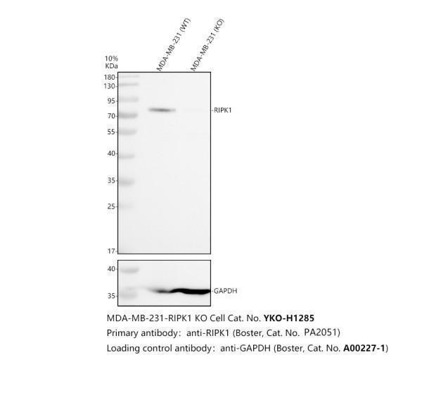 Western blot analysis of RIPK1 using anti-RIPK1 antibody (PA2051)