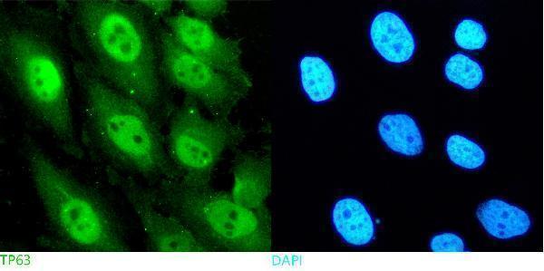 pa2056 p63 primary antibodies if testing 2